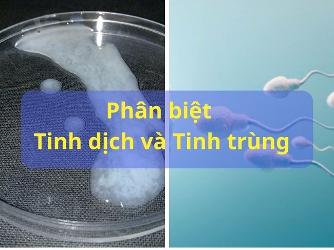 Tìm hiểu và phân biệt Tinh trùng và Tinh dịch