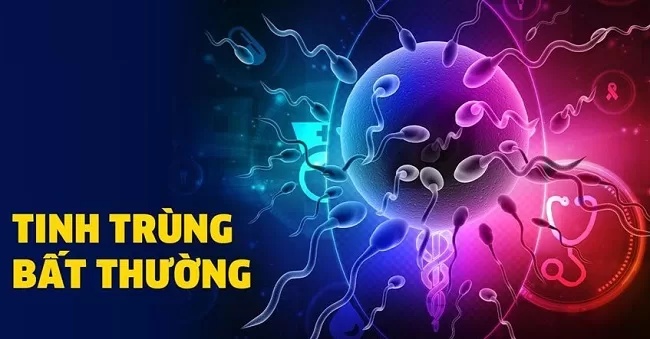 Các dạng tinh trùng bất thường gây cản trở quá trình thụ thai