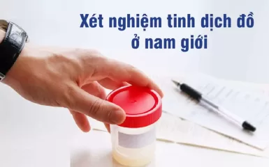 Xét nghiệm tinh dịch đồ hết bao nhiêu tiền, quy trình ra sao?