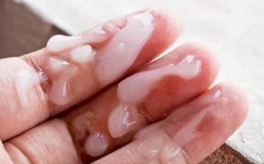Tinh trùng đặc gây bệnh gì: Dấu hiệu, nguyên nhân và cách điều trị