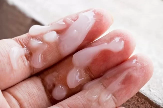 Tinh trùng đông đặc là tình trạng bất thường của tinh dịch do nhiều nguyên nhân gây nên