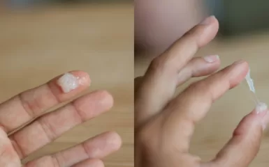 4 cách chữa tinh trùng đông đặc tại nhà dễ áp dụng nhất