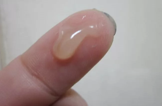 Tinh trùng đặc gây cản trở sự di chuyển của các tinh binh