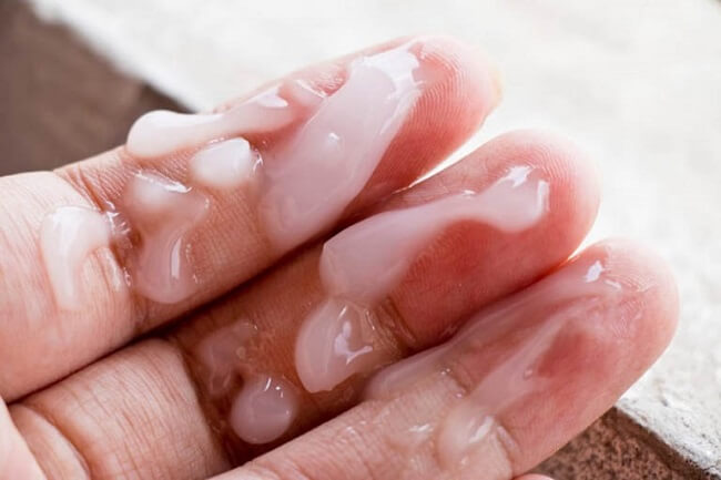 Hình ảnh tinh trùng có độ nhớt cao 