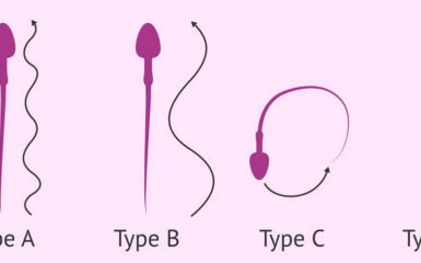 Tinh trùng di chuyển như thế nào, bạn có biết?