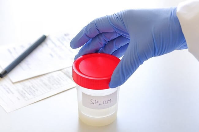 Xét nghiệm phân mảnh DNA tinh trùng
