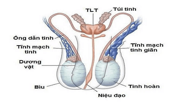 Giãn tĩnh mạch thừng tinh là một trong những bệnh gây vô sinh nam giới thường gặp