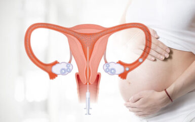 (Bật mí) Kinh nghiệm làm IUI thành công ngay từ lần 1