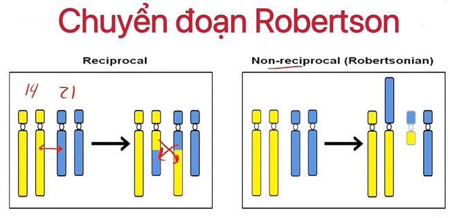 Chuyển đoạn Robertsonian