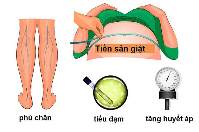 Mẹ bầu mang đa thai có nguy cơ cao bị tiền sản giật