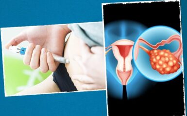 Tất tần tật về Hội chứng quá kích buồng trứng