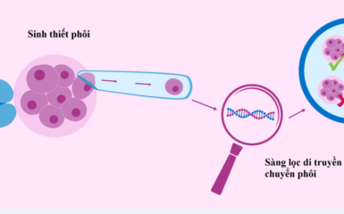 Từ A đến Z về sàng lọc phôi