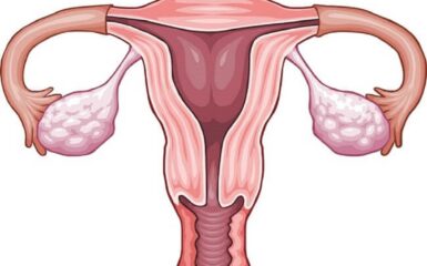 Đáp ứng buồng trứng kém - Những điều có thể bạn chưa biết