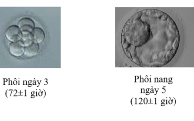 Toàn bộ thông tin về phôi ngày 3 và phôi ngày 5