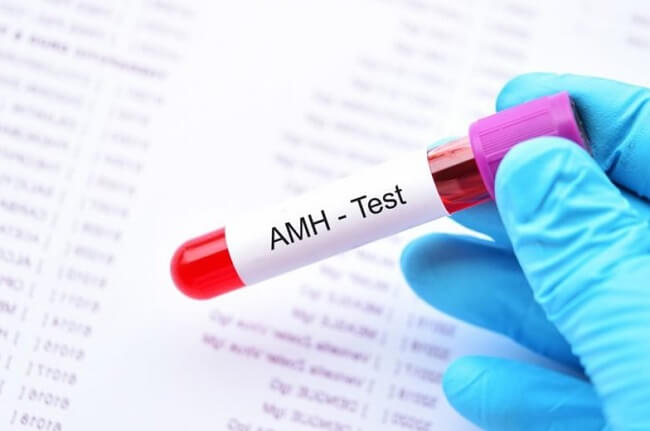 Xét nghiệm AMH