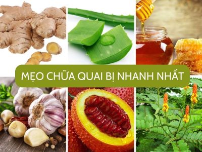 8 mẹo chữa quai bị nhanh nhất chưa ai nói cho bạn biết