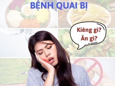 Quai bị kiêng gì và ăn gì để nhanh khỏi - Chuyên gia chia sẻ