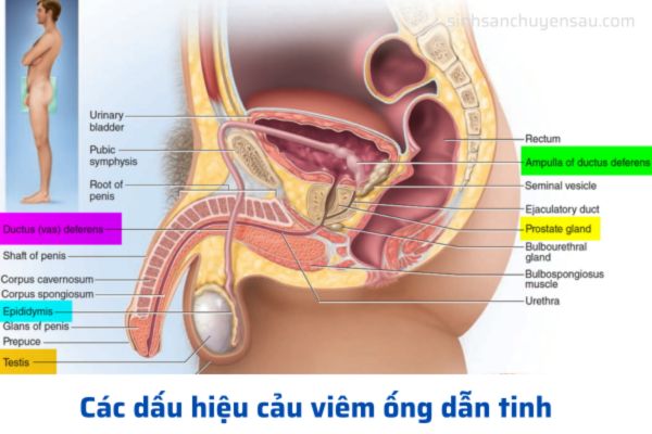 Viêm đường dẫn tinh có thể biểu hiện qua nhiều triệu chứng khác nhau