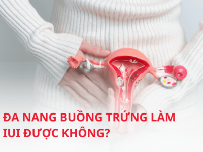 Tìm hiểu đa nang buồng trứng có làm IUI được không