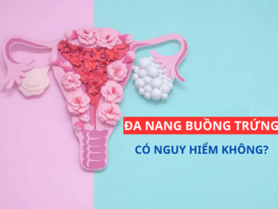 Tìm hiểu đa nang buồng trứng có nguy hiểm không