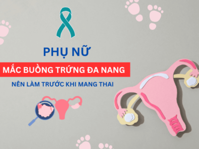 Những điều phụ nữ mắc PCOS nên làm trước khi muốn có thai