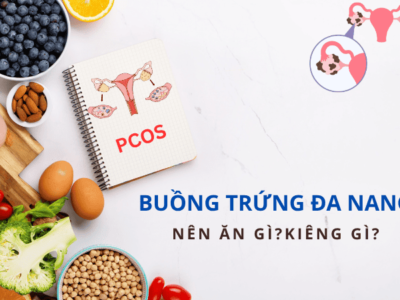PCOS nên ăn gì và kiêng gì